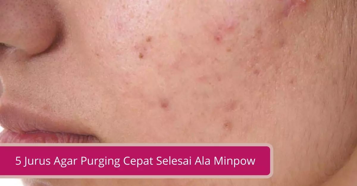 Gambar 5 Jurus Agar Purging Cepat Selesai Ala Minpow