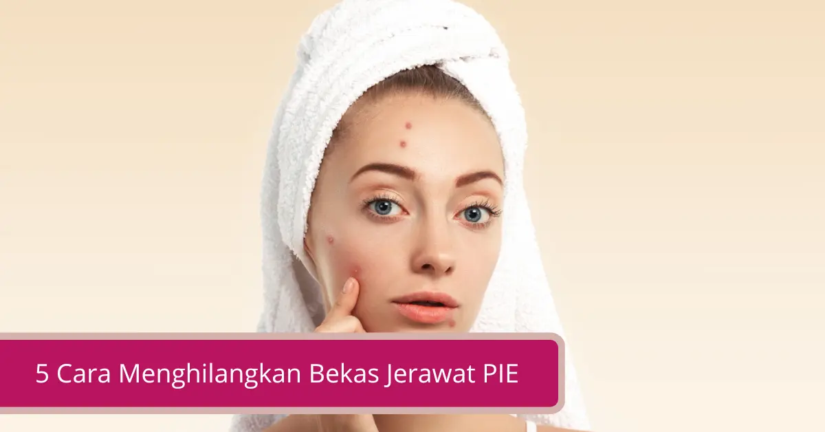 Gambar 5 Cara Menghilangkan Bekas Jerawat PIE