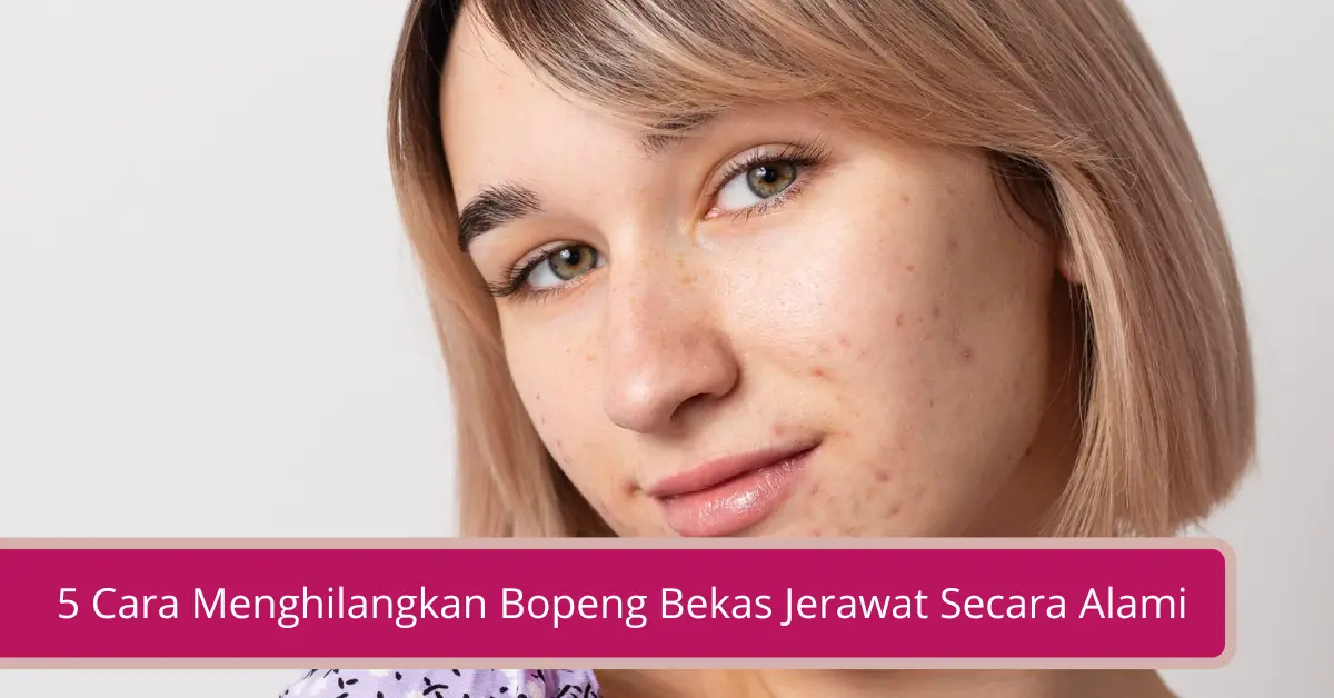 Gambar 5 Cara Menghilangkan Bopeng Bekas Jerawat Secara Alami