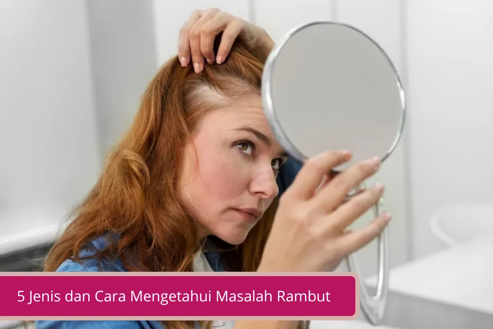 Gambar 5 Jenis dan Cara Mengetahui Masalah Rambut yang Perlu Kamu Pahami