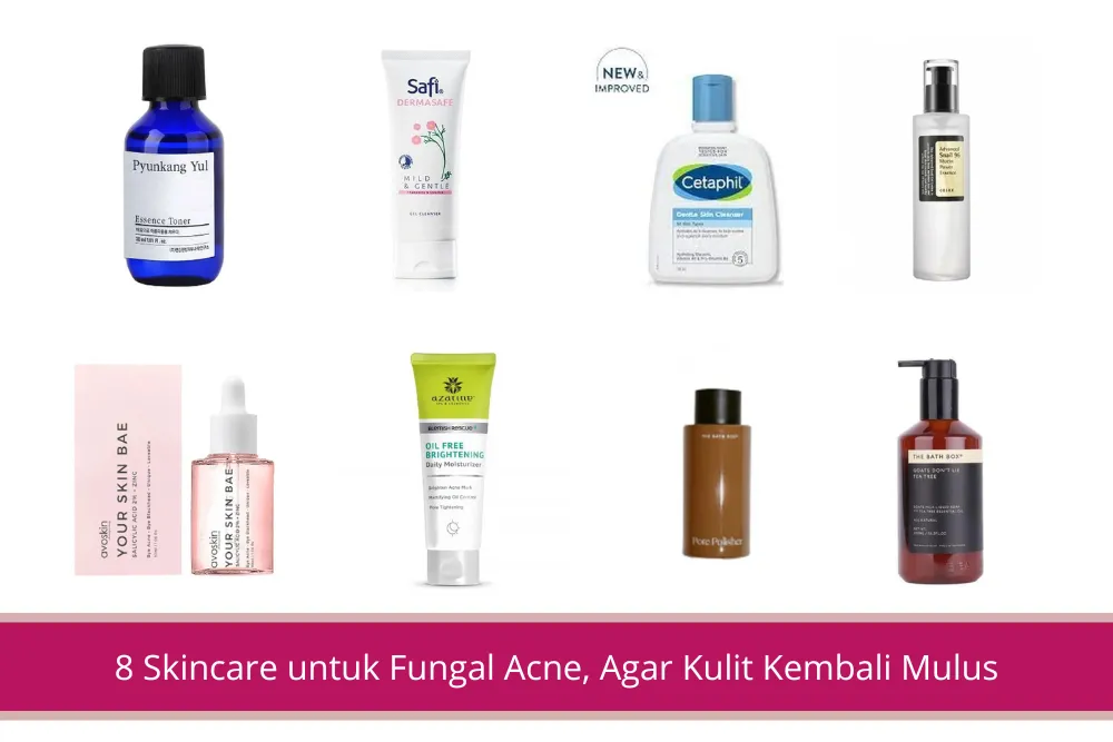 Gambar 8 Skincare untuk Fungal Acne Agar Kulit Kembali Mulus
